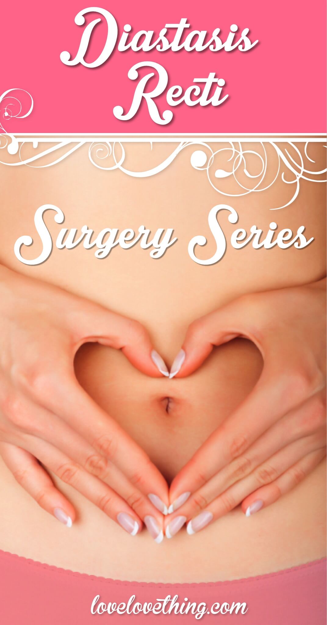 Diastasis Recti Surgery Update - One Year Later 1 Diastasis Recti Surgery Series