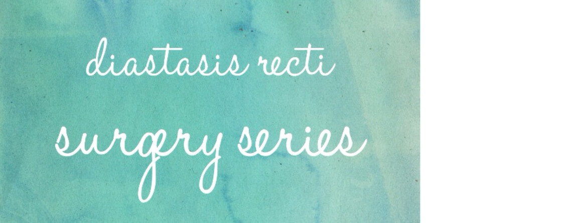 Diastasis Recti Surgery Series: Week 6 & Beyond {Updated} 1 diastasis recti surgery