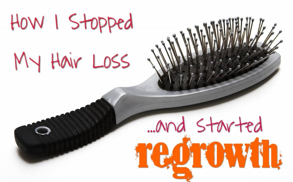 How I Stopped My Hair Loss and Started Regrowth 2 How I stopped my hair loss and started regrowth.