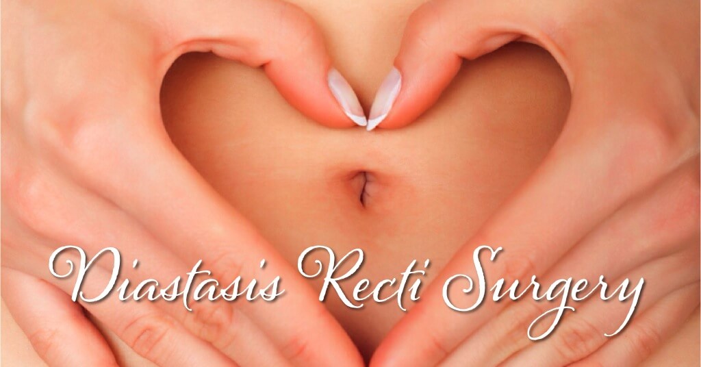 Diastasis Recti Surgery Photos 1 Diastasis Recti
